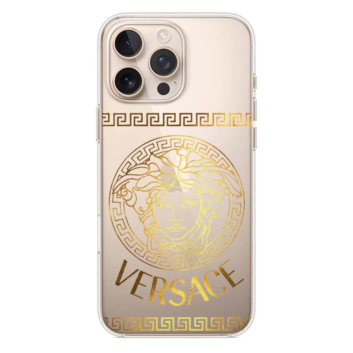 Versace Logolu Altın Desenli Telefon Kılıfı (HC31)