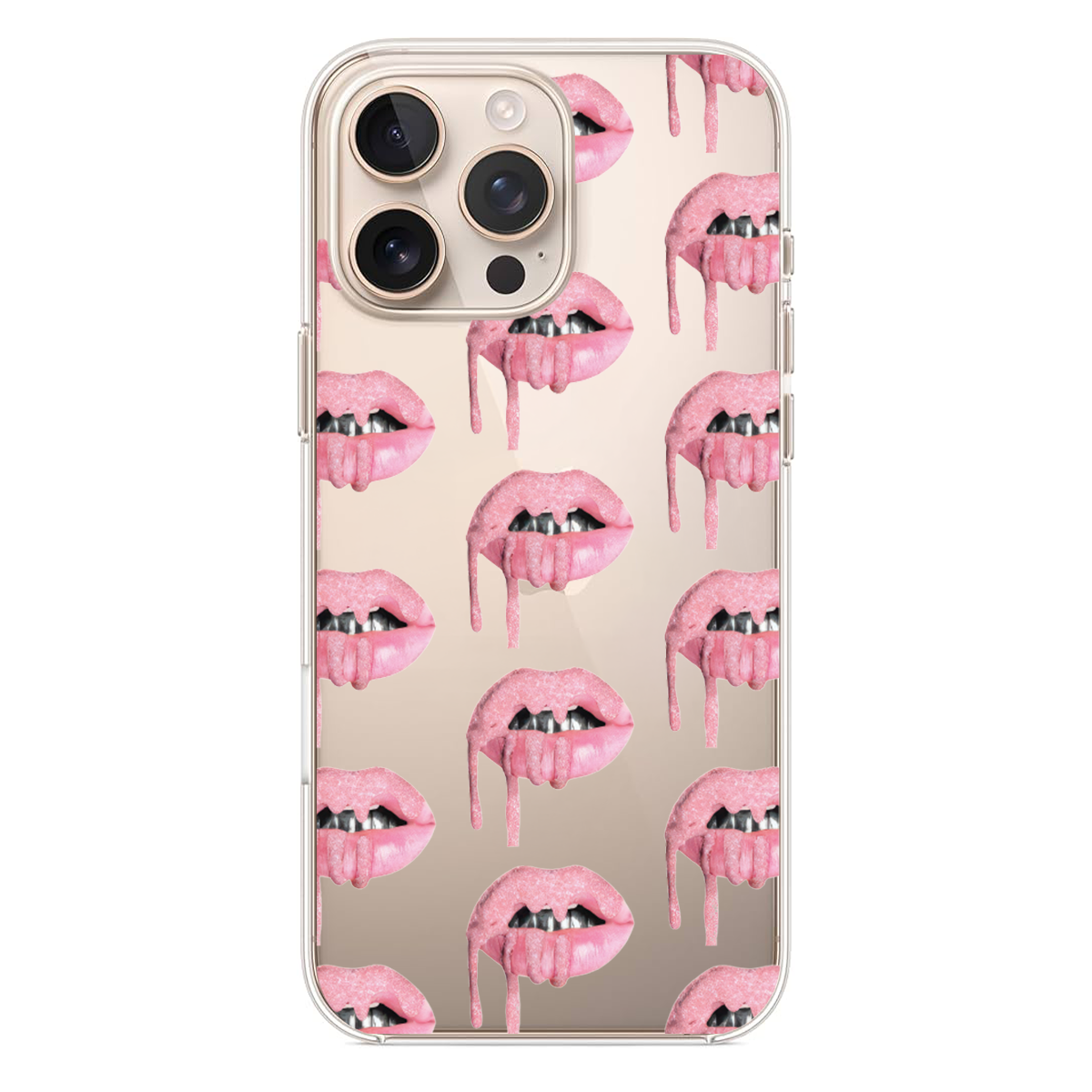 Pembe Simli Dudak Desenli Telefon Kılıfı (SV85)